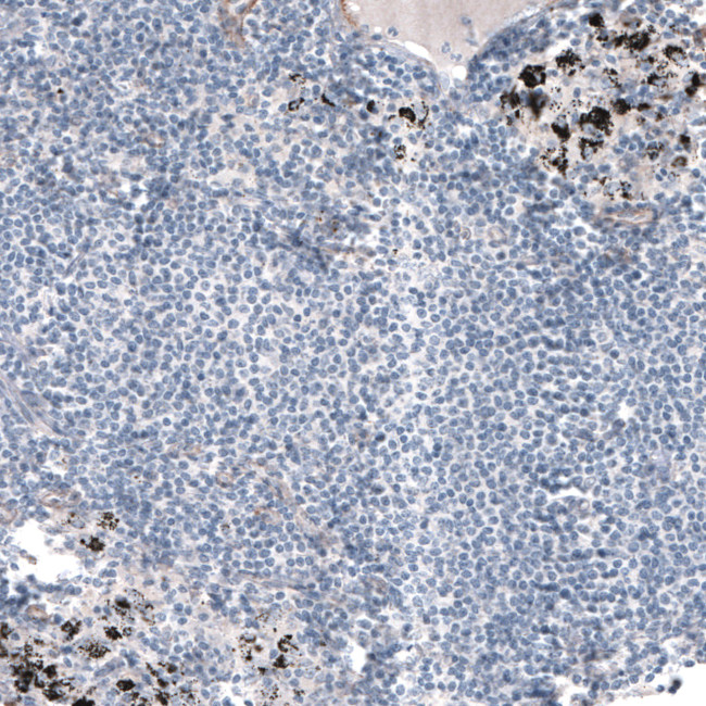 Laminin alpha-5 Antibody in Immunohistochemistry (IHC)