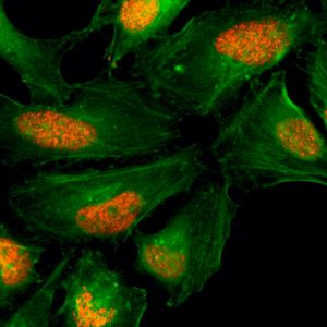 Histone H2A.X Antibody in Immunocytochemistry (ICC/IF)