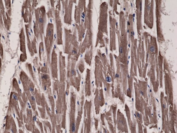 Acetyl-CoA Carboxylase Antibody in Immunohistochemistry (Paraffin) (IHC (P))