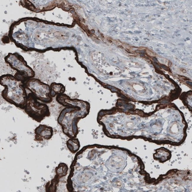 VISTA Antibody in Immunohistochemistry (IHC)