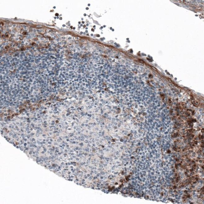 VISTA Antibody in Immunohistochemistry (IHC)