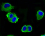 ATP Citrate Lyase Antibody in Immunocytochemistry (ICC/IF)