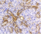 ATP Citrate Lyase Antibody in Immunohistochemistry (Paraffin) (IHC (P))