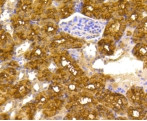 ATP Citrate Lyase Antibody in Immunohistochemistry (Paraffin) (IHC (P))