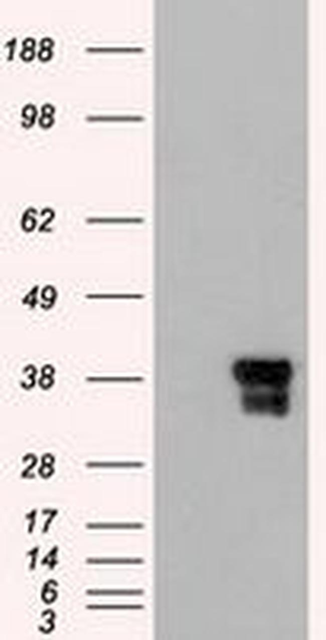 ICAD Antibody in Western Blot (WB)