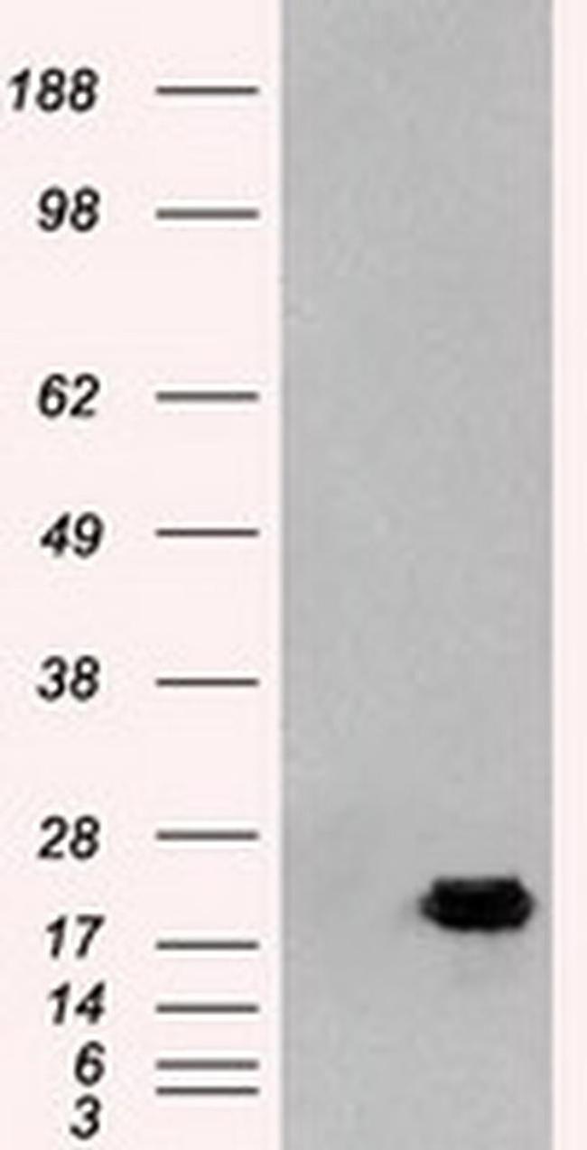 Adenylate Kinase 1 Antibody in Western Blot (WB)