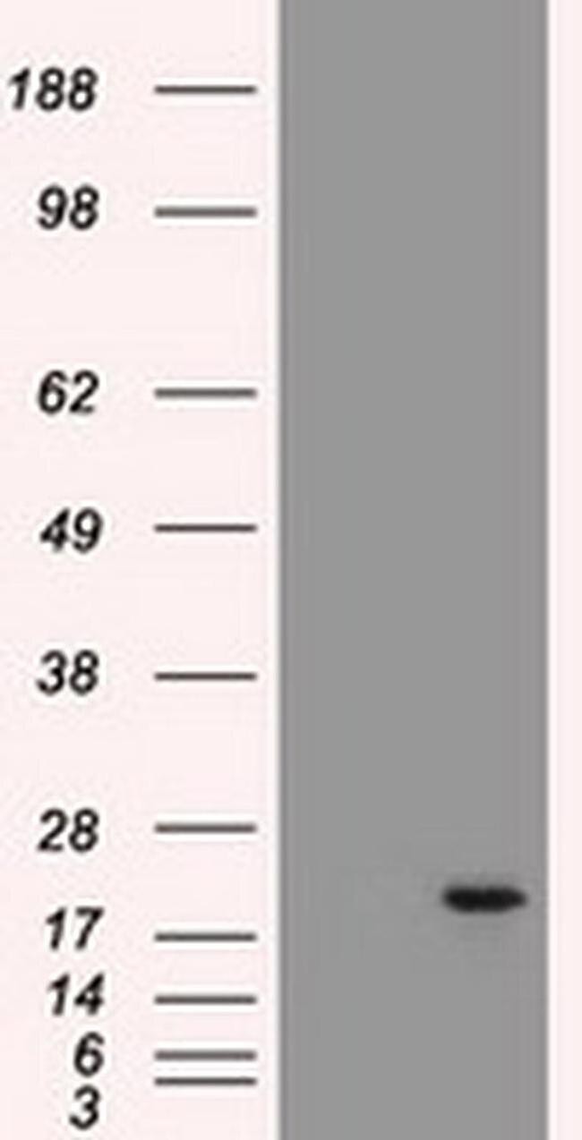 Adenylate Kinase 1 Antibody in Western Blot (WB)