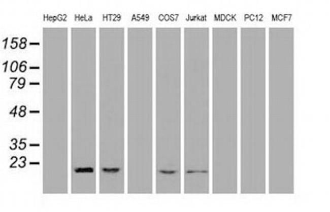 Adenylate Kinase 1 Antibody in Western Blot (WB)