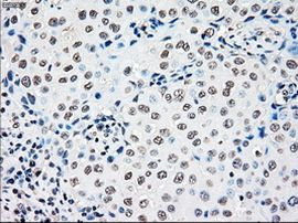 RAD9 Antibody in Immunohistochemistry (Paraffin) (IHC (P))