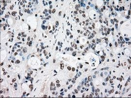 RAD9 Antibody in Immunohistochemistry (Paraffin) (IHC (P))