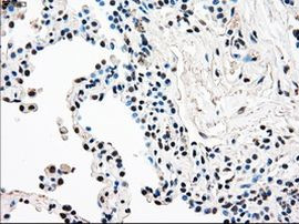 RAD9 Antibody in Immunohistochemistry (Paraffin) (IHC (P))