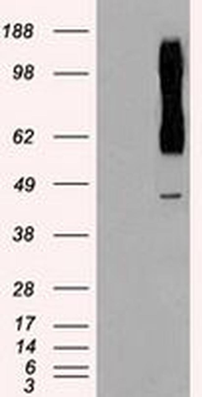 RAD9 Antibody in Western Blot (WB)