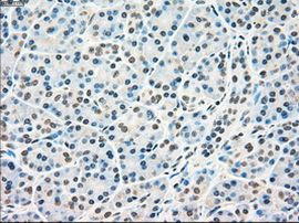 RAD9 Antibody in Immunohistochemistry (Paraffin) (IHC (P))