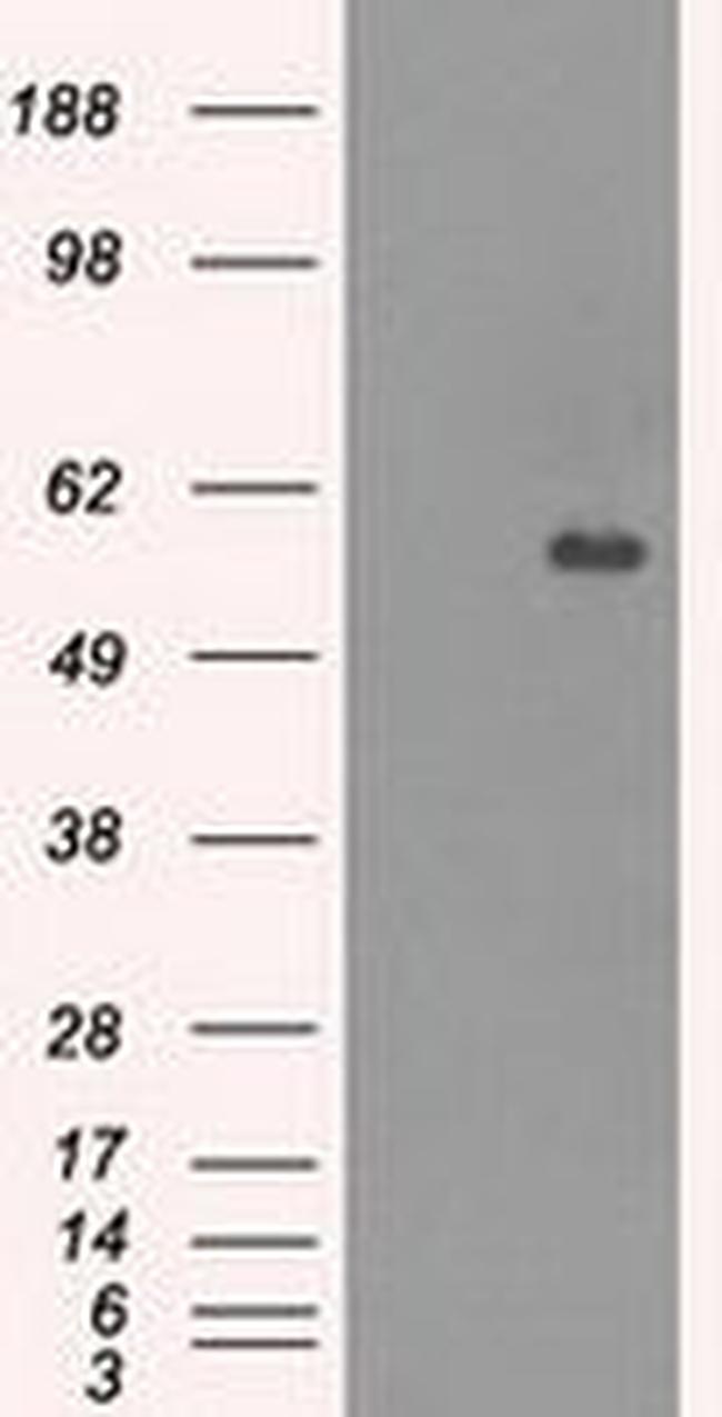 CNDP1 Antibody in Western Blot (WB)