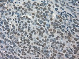 TRIB2 Antibody in Immunohistochemistry (Paraffin) (IHC (P))