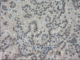 TRIB2 Antibody in Immunohistochemistry (Paraffin) (IHC (P))