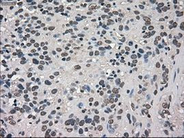 TRIB2 Antibody in Immunohistochemistry (Paraffin) (IHC (P))