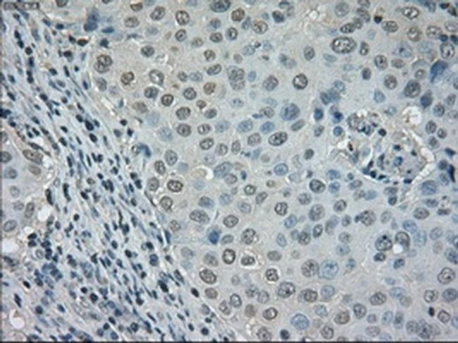 DHFR Antibody in Immunohistochemistry (Paraffin) (IHC (P))