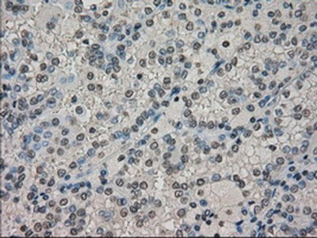 DHFR Antibody in Immunohistochemistry (Paraffin) (IHC (P))