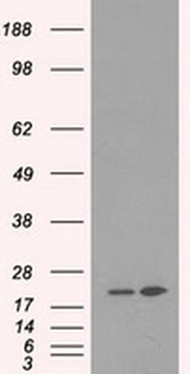 DHFR Antibody in Western Blot (WB)