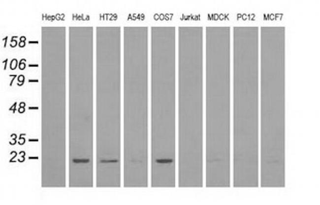 DHFR Antibody in Western Blot (WB)