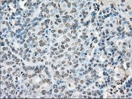 Cytochrome P450 Reductase Antibody in Immunohistochemistry (Paraffin) (IHC (P))