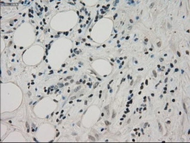 PPP1R7 Antibody in Immunohistochemistry (Paraffin) (IHC (P))