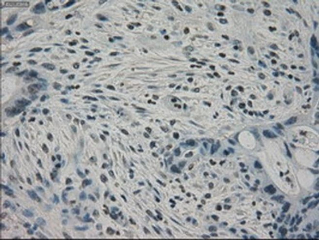 PPP1R7 Antibody in Immunohistochemistry (Paraffin) (IHC (P))