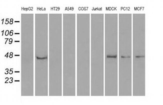 PPP1R7 Antibody in Western Blot (WB)