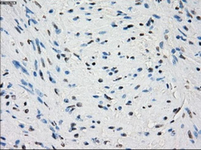 PDE10A Antibody in Immunohistochemistry (Paraffin) (IHC (P))