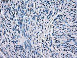 BCKDK Antibody in Immunohistochemistry (Paraffin) (IHC (P))