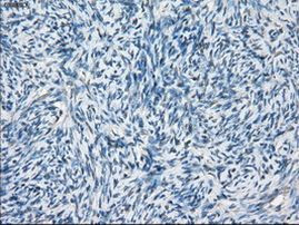 BCKDK Antibody in Immunohistochemistry (Paraffin) (IHC (P))