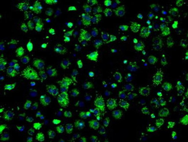 ERAB Antibody in Immunocytochemistry (ICC/IF)