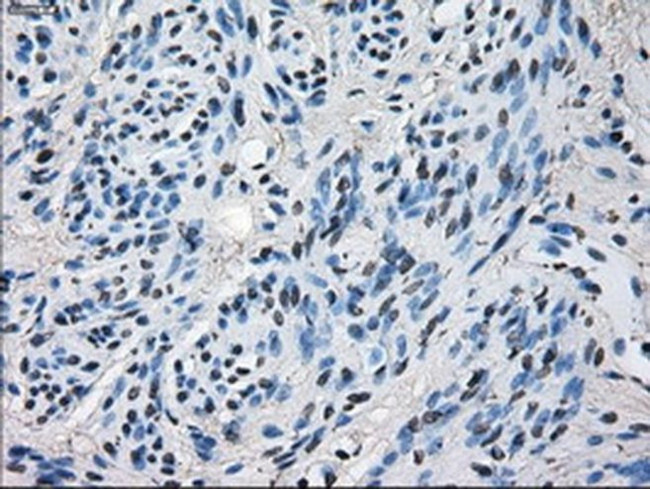 ERAB Antibody in Immunohistochemistry (Paraffin) (IHC (P))