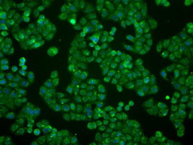 BTN3A2 Antibody in Immunocytochemistry (ICC/IF)