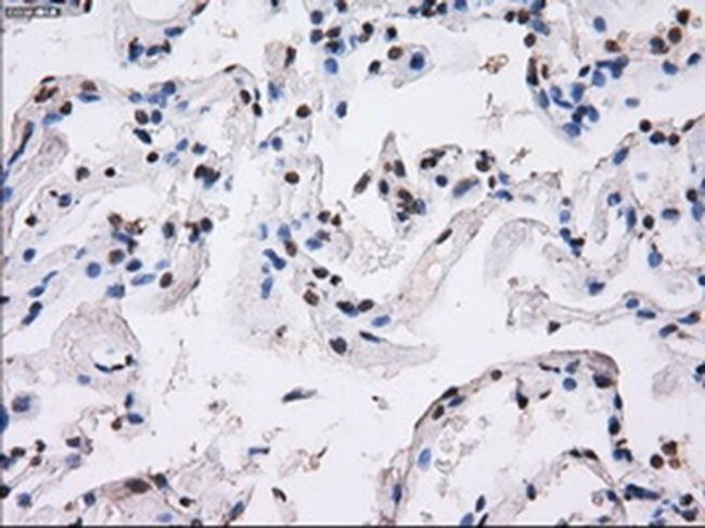 BTN3A2 Antibody in Immunohistochemistry (Paraffin) (IHC (P))