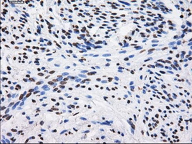 BTN3A2 Antibody in Immunohistochemistry (Paraffin) (IHC (P))