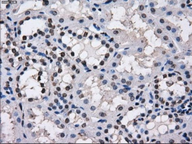 TTLL12 Antibody in Immunohistochemistry (Paraffin) (IHC (P))