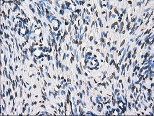 TTLL12 Antibody in Immunohistochemistry (Paraffin) (IHC (P))