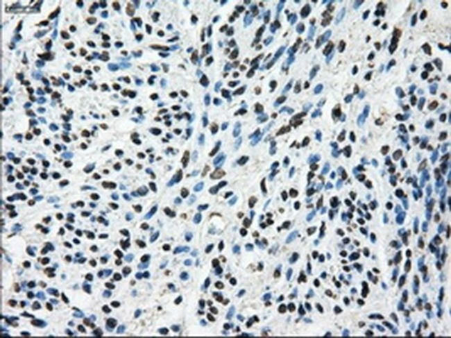 TTLL12 Antibody in Immunohistochemistry (Paraffin) (IHC (P))