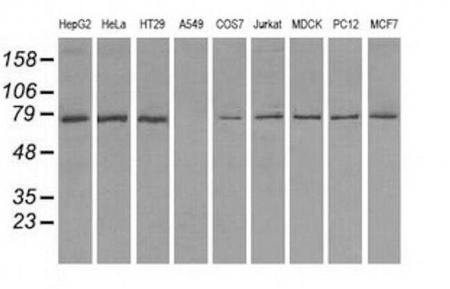 TTLL12 Antibody in Western Blot (WB)