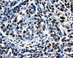 PSMC3 Antibody in Immunohistochemistry (Paraffin) (IHC (P))