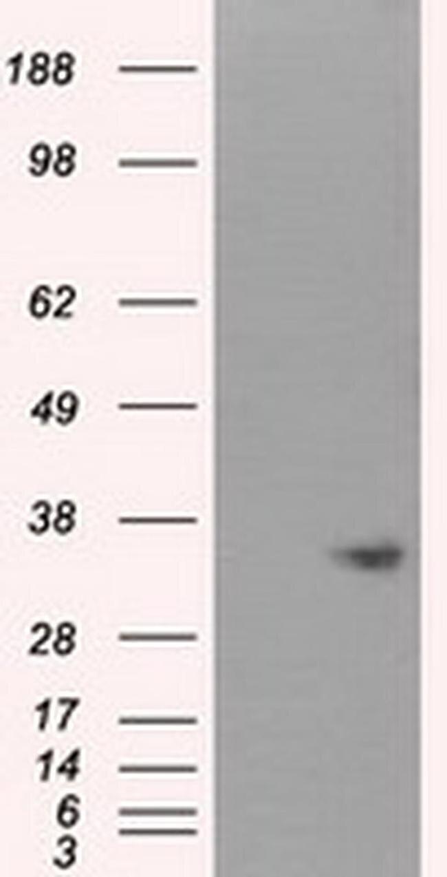 NIT1 Antibody in Western Blot (WB)