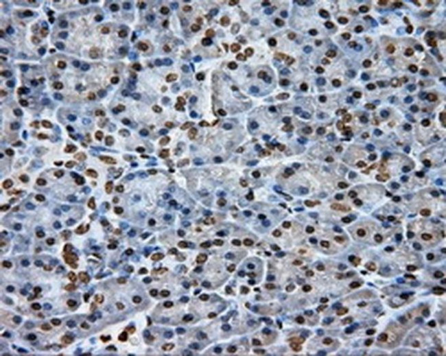 DAPK2 Antibody in Immunohistochemistry (Paraffin) (IHC (P))