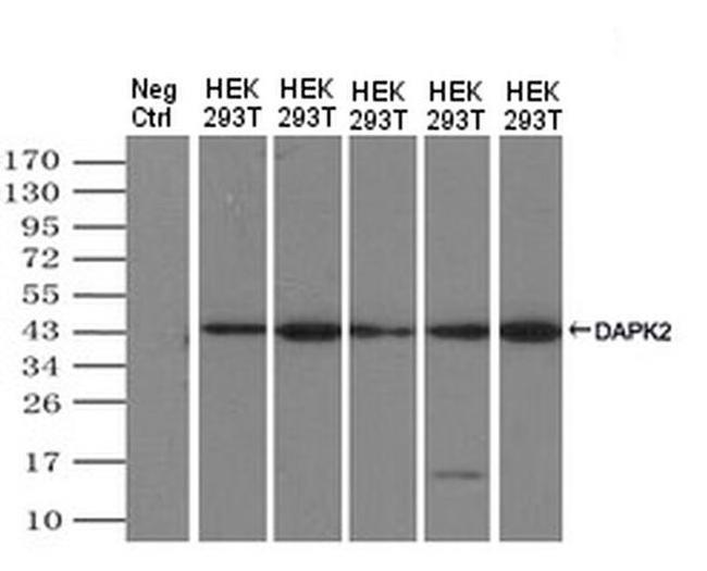 DAPK2 Antibody in Western Blot (WB)