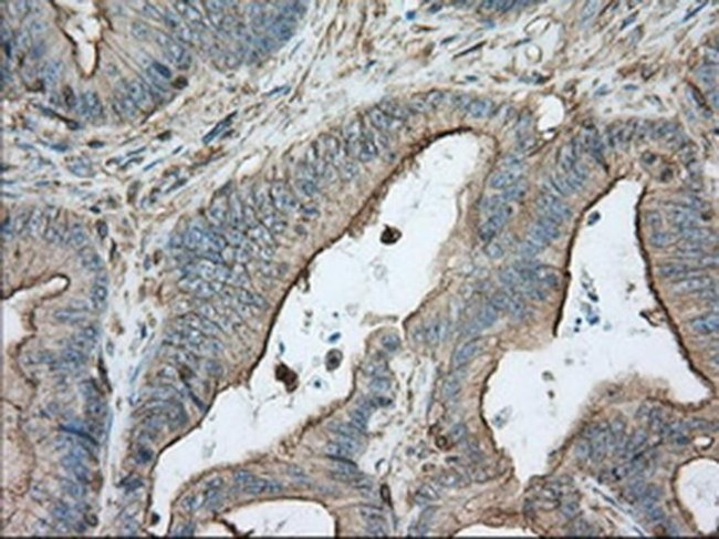 ALDH3A1 Antibody in Immunohistochemistry (Paraffin) (IHC (P))