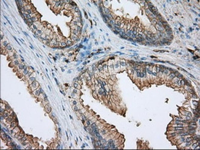 ALDH3A1 Antibody in Immunohistochemistry (Paraffin) (IHC (P))