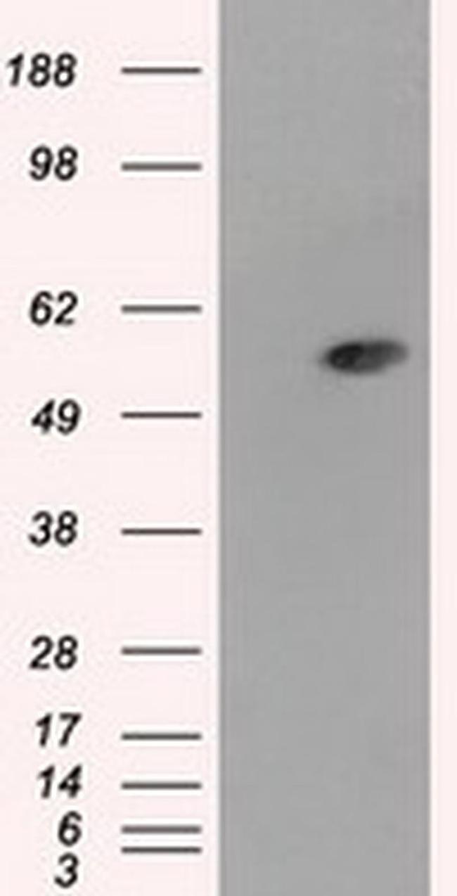 ALDH3A1 Antibody in Western Blot (WB)