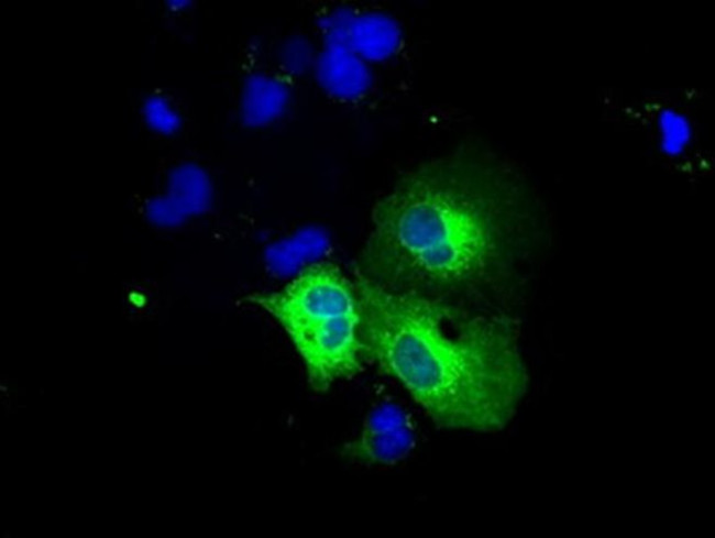 VAT1L Antibody in Immunocytochemistry (ICC/IF)