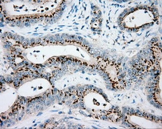 VAT1L Antibody in Immunohistochemistry (Paraffin) (IHC (P))